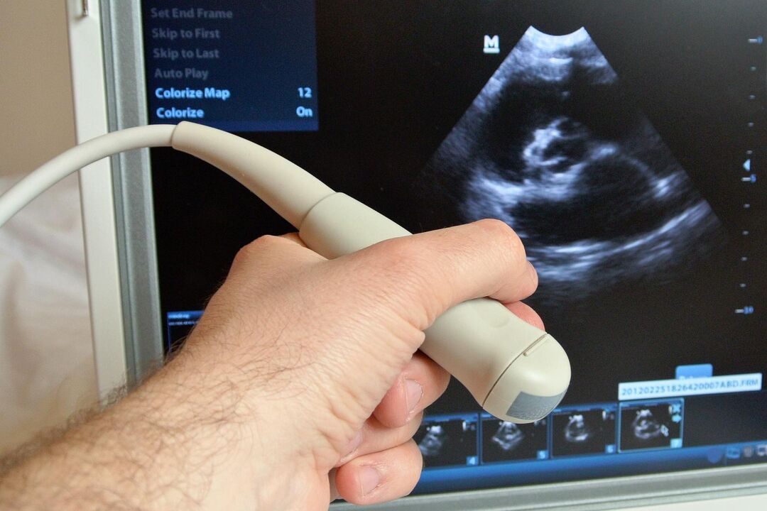 Az ultrahang segít diagnosztizálni a pangásos prosztatagyulladást egy férfiban
