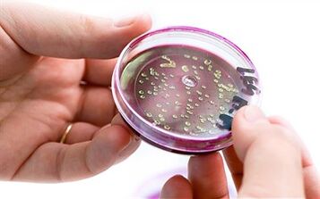 Baktériumok a prosztata szekréciójában